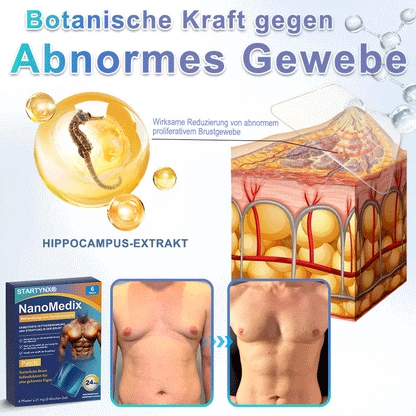 🔥STARTYNX®NanoMedix™ Gynecomastia Breast Fat Burning & Firming Patch