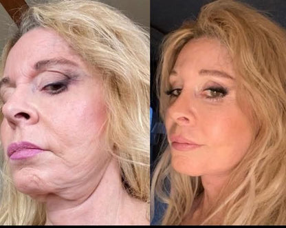 🐝🌿Ringmiz Botox BeeVenom Firming SerumStick-(Made and shippedfrom Australia)-LASTDAY 70% OFF