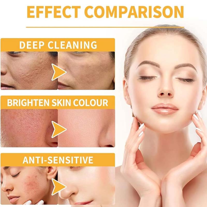 🎄Christmas Sale 50% OFF🌟🧴Gentle Exfoliating Moisturizing Body Spray- Makes Skin Soft